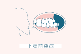 子供 歯科矯正 補助金