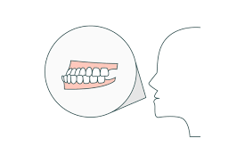 子供 歯科矯正 補助金