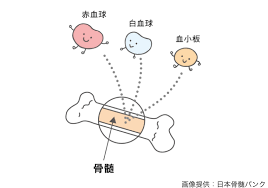 骨髄 ドナー 助成金