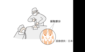 骨髄 ドナー 助成金